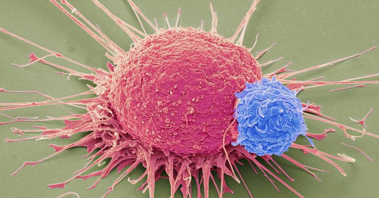The Most Promising Most cancers Remedies In a Century Have Arrived—However Not For Everybody